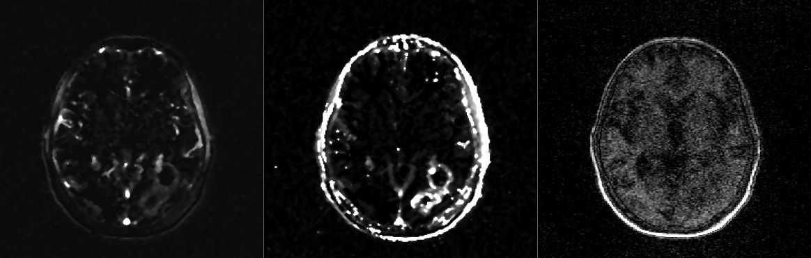 Three panels are shown of a 2D slice of a human brain. The left two are much higher contrast than the rightmost, being totally dark in some areas and very bright in others.