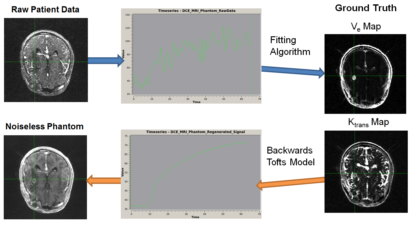 A schematic is shown. An image of a brain with signal noise labeled 'Raw Patient Data' is connected via an arrow to a chart of a noisy time series. That image is connected to two more ktrans and ve brain images labeled 'Ground Truth', with the caption 'Fitting Algorithm.' Those images are connected back to another time series diagram with the caption 'Backward Tofts Algorithm.' This time series diagram is then linked to an noiseless brain labeled 'Noiseless Phantom'